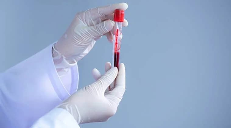Delhi And Maharashtra Opt For Plasma The