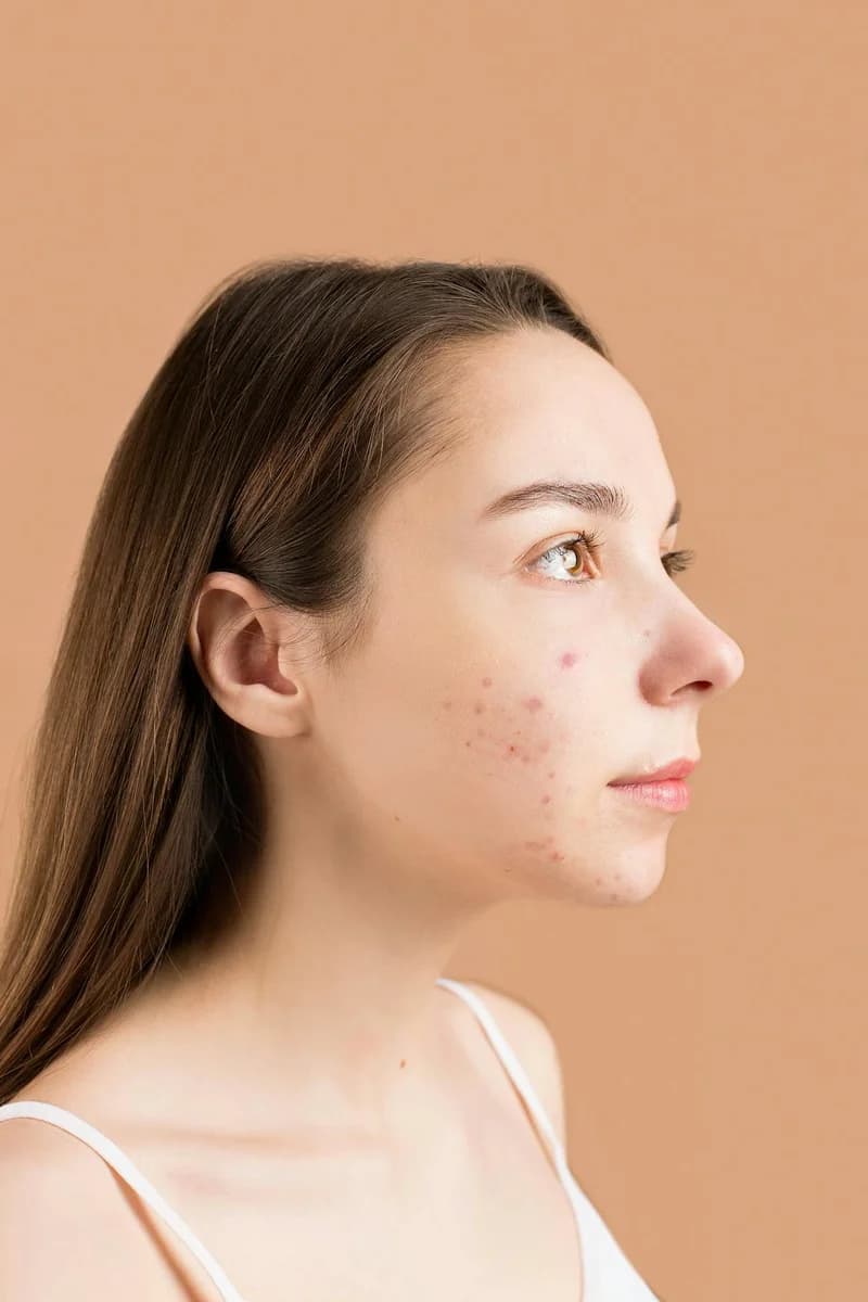 Redefining Beauty – Celebrating The Skin You Are In