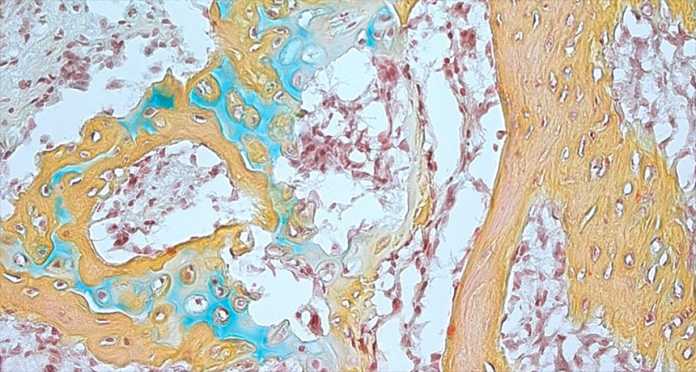 Scientists Discover Stem Cell That Helps Bones And Cartilages Grow