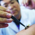 bee venom(sticky innovation ened)